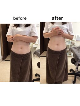 ジョワイユ(Joyeux)/腸の位置でお腹は変わる