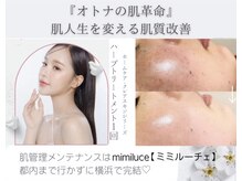 ミミルーチェ(mimiluce)