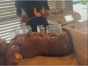 ウルル 福岡(Uluru)/本格的なカッピング