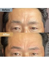 眉毛ハウス 吉祥寺店(眉毛HOUSE)/お客様の施術例(吉祥寺/東京)