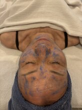 エミナル(EMINALu)/次世代ピーリングはこれで決まり