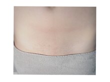 レイワックススタジオ(Lei wax studio)の雰囲気（全身各パーツメニューあり◎気になる箇所だけOK！都度払い制★）