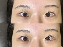 シエンテ(Ciente)/奥二重さん