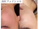 ロンド(Lond)の写真