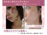 国産ハーバルピール【毛穴・くすみ改善】本気の肌質改善60分￥23,100