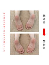 ナチュラルハリー(NaturalHarry)/【足ツボbefore→after】