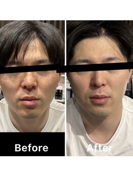 ブルーミントビューティー(blue mint Beauty)/レストセルトリートメント