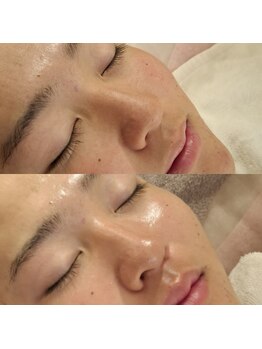 バリューネクスト 青葉台/◆LHAララピール◆