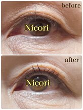 ニコリ(Nicori)/アイリッドアップパーマ