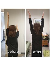 ストライクボディケア(STRIKE. BODY CARE)/肩関節の痛み