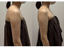 スキャプレーン 米子(SCAPLANE)/BEFORE AFTER事例