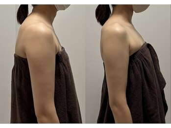 スキャプレーン 米子(SCAPLANE)/BEFORE AFTER事例