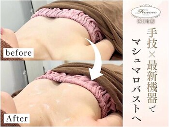 ロココ 四日市店(Rococo)の写真/1人1人に合ったお手入れ内容&本格改善バストケア♪姿勢からしっかり根本改善する事でお悩みを一気に解決！