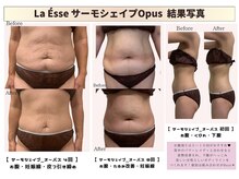 ラエッセ(La Esse)/ぽよぽよお腹も引き締め！