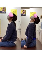 ヒデ整体院(Hide整体院)/猫背矯正骨盤矯正B/A肩こり腰痛