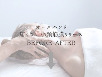 ジュプン 長崎/小顔筋膜ビフォーアフター