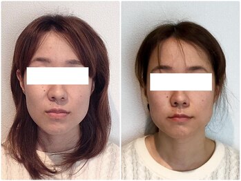 美容整体ウェリナ 名駅院/小顔矯正/骨盤矯正/美脚サロン