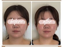 ル メルシェ(Lemerci)/１回でこの変化！！！