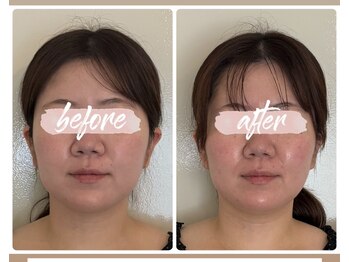 ル メルシェ(Lemerci)/１回でこの変化！！！