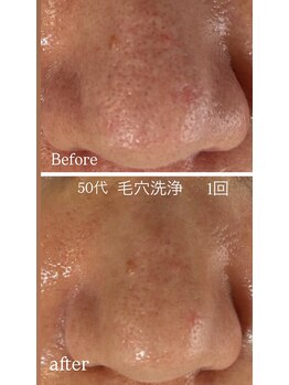 マリエンドリー/