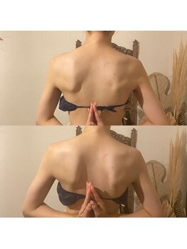 ソバニ(SOBANI)/背中の不要なもの