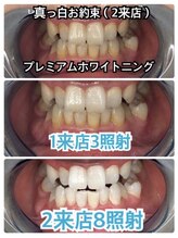 グレイスホワイトニング ヨコハマ(Grace Whitening Yokohama)/2来店8照射