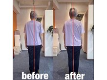 カワル整体 上通り院/お尻が垂れる姿勢