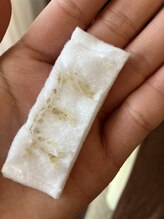 リンカ(Rinca)/毛穴ケア/尾張旭市/瀬戸市