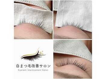 ラヴィラ(La villa)/丁寧なカウンセリングと層の見極