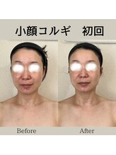 リーブル(LIBRE)/小顔コルギ　初回