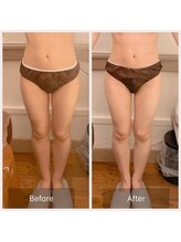 カルナ(carna)/《2か月計4回》2週間に1回