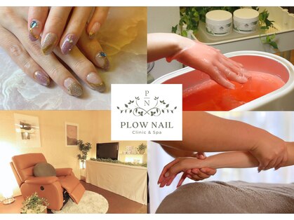 プラウネイル(Plow Nail)の写真