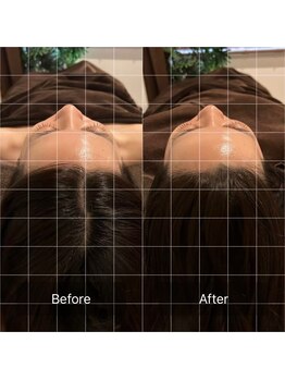 アン シェリー(un Cherie)/頭の大きさに変化あり!