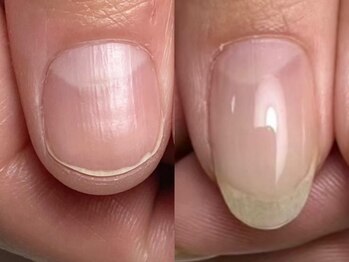 リリーの写真/深爪・噛むクセ、爪の形を綺麗にしたいなど爪のお悩みを解消するサロン◆丁寧なケアで自信が持てる手元へ♪