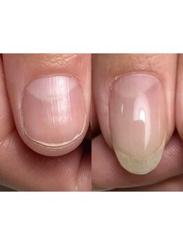 爪の悩みを解消できる（ケア含む）