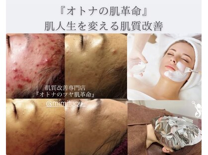 ミミルーチェ(mimiluce)の写真