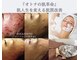 ミミルーチェ(mimiluce)の写真