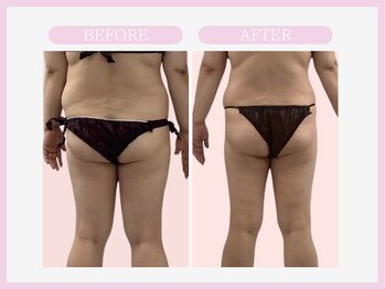 アコガレコガオ 八戸店/