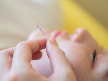 ゆめたか接骨院 鍼灸院 整体院 大沢野院/骨盤整体と美容鍼Wケアが効果◎