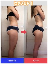 カルミア 心斎橋店/ゼロコース/20代のお客様