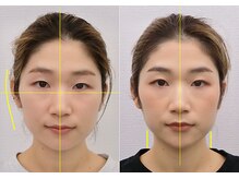 宮崎整体院/【小顔矯正・顔の歪み矯正】