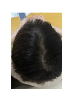 キュライム カブール町田店/健康な髪へ