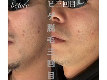 リツイート(ReTweet)/