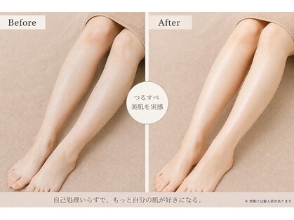 エスポワール ビューティ(Espoir beaute)の写真
