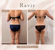 ラヴィ(Raviy)