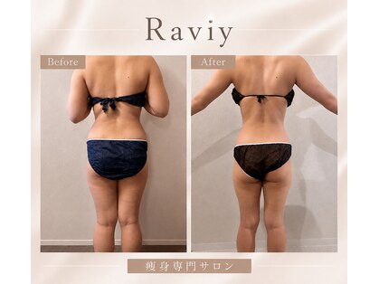 ラヴィ(Raviy)の写真