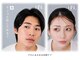 エンナ スタジオ(enna studio)の写真/人気のHBLハリウッドブロウリフトで眉毛を美しく!憧れの自分に出会える◎