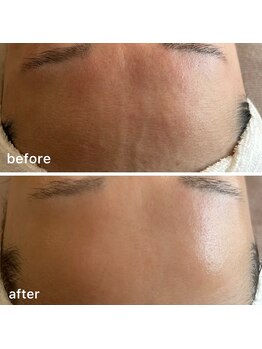 オーク(o.a.k)/肌質改善ハーブ