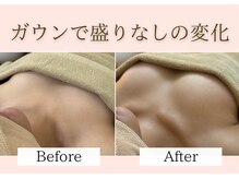 育乳×整体の全身施術により【骨格筋が変わる】確実な変化◎