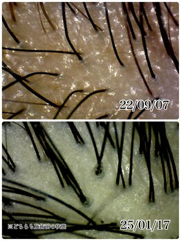 ミルラ(myrrh)/ケアを続けて髪質改善＆向上